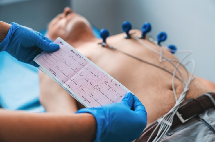 ECG (Electrocardiogram) Testing