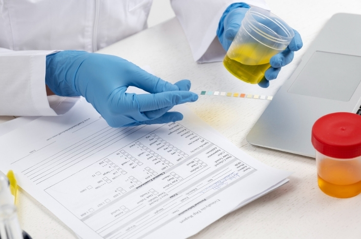 Urine Tests